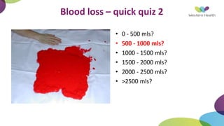 Blood loss – quick quiz 2
• 0 - 500 mls?
• 500 - 1000 mls?
• 1000 - 1500 mls?
• 1500 - 2000 mls?
• 2000 - 2500 mls?
• >2500 mls?
 
