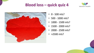 Blood loss – quick quiz 4
• 0 - 500 mls?
• 500 - 1000 mls?
• 1000 - 1500 mls?
• 1500 - 2000 mls?
• 2000 - 2500 mls?
• >2500 mls?
 