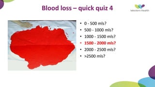 Blood loss – quick quiz 4
• 0 - 500 mls?
• 500 - 1000 mls?
• 1000 - 1500 mls?
• 1500 - 2000 mls?
• 2000 - 2500 mls?
• >2500 mls?
 