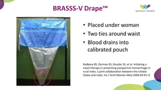 BRASSS-V Drape™
• Placed under woman
• Two ties around waist
• Blood drains into
calibrated pouch
Kodkany BS, Derman RJ, Goudar SS, et al. Initiating a
novel therapy in preventing postpartum hemorrhage in
rural India: a joint collaboration between the United
States and India. Int J Fertil Women Med 2004;49:91–6
 