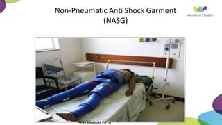 Non-Pneumatic Anti Shock Garment
(NASG)
PPH Module 2014
 