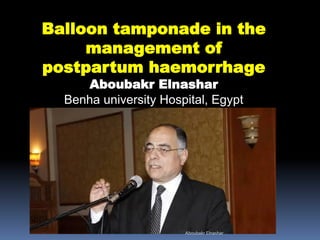 Balloon tamponade in the
management of
postpartum haemorrhage
Aboubakr Elnashar
Benha university Hospital, Egypt
Aboubakr Elnashar
 