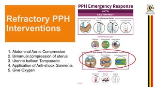 Postpartum Hemorrhage_Management_presenation[2].pptx