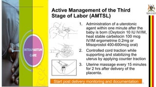 Postpartum Hemorrhage_Management_presenation[2].pptx