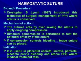 Pph managment rabi | PPT