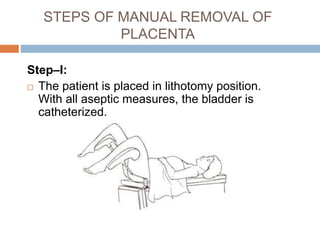 STEPS OF MANUAL REMOVAL OF
PLACENTA
Step–I:
 The patient is placed in lithotomy position.
With all aseptic measures, the bladder is
catheterized.
 