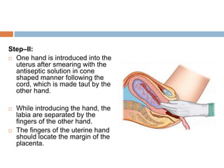 Step–II:
 One hand is introduced into the
uterus after smearing with the
antiseptic solution in cone
shaped manner following the
cord, which is made taut by the
other hand.
 While introducing the hand, the
labia are separated by the
fingers of the other hand.
 The fingers of the uterine hand
should locate the margin of the
placenta.
 