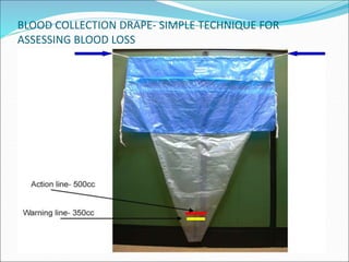 BLOOD COLLECTION DRAPE- SIMPLE TECHNIQUE FOR
ASSESSING BLOOD LOSS
 
