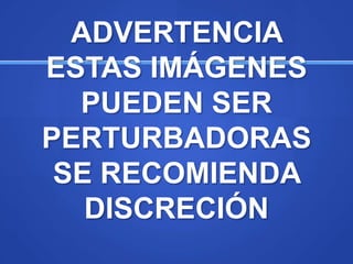 ADVERTENCIA
ESTAS IMÁGENES
  PUEDEN SER
PERTURBADORAS
 SE RECOMIENDA
   DISCRECIÓN
 