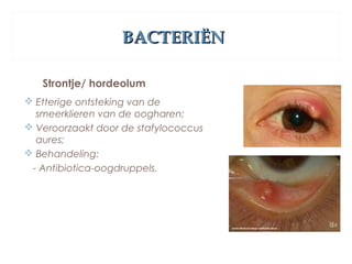 BACTERIËNBACTERIËN
Strontje/ hordeolum
 Etterige ontsteking van de
smeerklieren van de oogharen;
 Veroorzaakt door de stafylococcus
aures;
 Behandeling:
- Antibiotica-oogdruppels.
 