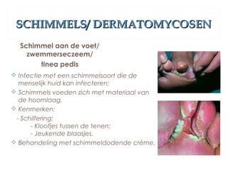 SCHIMMELS/ DERMATOMYCOSENSCHIMMELS/ DERMATOMYCOSEN
Schimmel aan de voet/
zwemmerseczeem/
tinea pedis
 Infectie met een schimmelsoort die de
menselijk huid kan infecteren;
 Schimmels voeden zich met materiaal van
de hoornlaag.
 Kenmerken:
- Schilfering;
- Kloofjes tussen de tenen;
- Jeukende blaasjes.
 Behandeling met schimmeldodende crème.
 