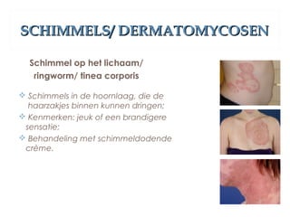 SCHIMMELS/ DERMATOMYCOSENSCHIMMELS/ DERMATOMYCOSEN
Schimmel op het lichaam/
ringworm/ tinea corporis
 Schimmels in de hoornlaag, die de
haarzakjes binnen kunnen dringen;
 Kenmerken: jeuk of een brandigere
sensatie;
 Behandeling met schimmeldodende
crème.
 