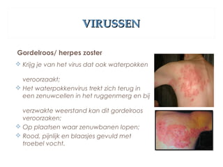 VIRUSSENVIRUSSEN
Gordelroos/ herpes zoster
 Krijg je van het virus dat ook waterpokken
veroorzaakt;
 Het waterpokkenvirus trekt zich terug in
een zenuwcellen in het ruggenmerg en bij
verzwakte weerstand kan dit gordelroos
veroorzaken;
 Op plaatsen waar zenuwbanen lopen;
 Rood, pijnlijk en blaasjes gevuld met
troebel vocht.
 