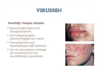 VIRUSSENVIRUSSEN
Koortslip/ herpes simplex
 Besmettelijk tijdens het
blaasjesstadium;
 Na indroging geen
besmettingsgevaar meer;
 Gevoeligheid voor
koortsblaasjes blijft bestaan;
 Zon en zonnebank verlaagt
de weerstand en kan
koortsblaasjes opwekken.
 