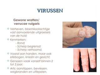 VIRUSSENVIRUSSEN
Gewone wratten/
verrucae vulgaris
 Verheven, bloemkoolachtige
vast aanvoelende uitgroeisels
van de huid;
 Kenmerken:
- Rond;
- Scherp begrensd;
- Scherp verhoornd.
 Vooral aan handen, maar ook
ellebogen, knieën en gezicht;
 Genezen vaak vanzelf binnen 2
tot 3 jaar;
 Arts: aanstippen, bevriezen,
wegbranden en uitlepelen.
 