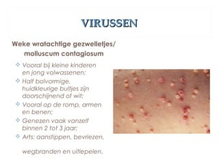 VIRUSSENVIRUSSEN
Weke wratachtige gezwelletjes/
molluscum contagiosum
 Vooral bij kleine kinderen
en jong volwassenen;
 Half bolvormige,
huidkleurige bultjes zijn
doorschijnend of wit;
 Vooral op de romp, armen
en benen;
 Genezen vaak vanzelf
binnen 2 tot 3 jaar;
 Arts: aanstippen, bevriezen,
wegbranden en uitlepelen.
 