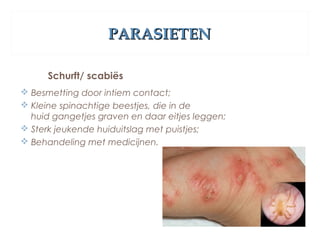 PARASIETENPARASIETEN
Schurft/ scabiës
 Besmetting door intiem contact;
 Kleine spinachtige beestjes, die in de
huid gangetjes graven en daar eitjes leggen; 
 Sterk jeukende huiduitslag met puistjes;
 Behandeling met medicijnen.
 