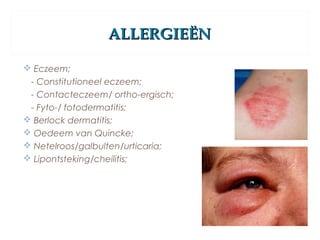 ALLERGIEËNALLERGIEËN
 Eczeem;
- Constitutioneel eczeem;
- Contacteczeem/ ortho-ergisch;
- Fyto-/ fotodermatitis;
 Berlock dermatitis;
 Oedeem van Quincke;
 Netelroos/galbulten/urticaria;
 Lipontsteking/cheilitis;
 