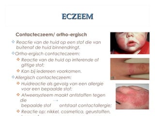 ECZEEMECZEEM
Contacteczeem/ ortho-ergisch
 Reactie van de huid op een stof die van
buitenaf de huid binnendringt.
Ortho-ergisch contacteczeem:
 Reactie van de huid op irriterende of
giftige stof;
 Kan bij iedereen voorkomen.
Allergisch contacteczeem:
 Huidreactie als gevolg van een allergie
voor een bepaalde stof;
 Afweersysteem maakt antistoffen tegen
die
bepaalde stof ontstaat contactallergie;
 Reactie op: nikkel, cosmetica, geurstoffen,
 