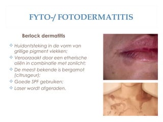 FYTO-/ FOTODERMATITIS
Berlock dermatitis
 Huidontsteking in de vorm van
grillige pigment vlekken;
 Veroorzaakt door een etherische
oliën in combinatie met zonlicht;
 De meest bekende is bergamot
(citrusgeur);
 Goede SPF gebruiken;
 Laser wordt afgeraden.
 