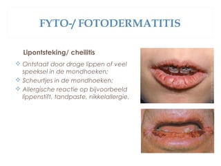 FYTO-/ FOTODERMATITIS
Lipontsteking/ cheilitis
 Ontstaat door droge lippen of veel
speeksel in de mondhoeken;
 Scheurtjes in de mondhoeken;
 Allergische reactie op bijvoorbeeld
lippenstift, tandpaste, nikkelallergie.
 
