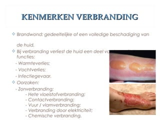 KENMERKEN VERBRANDINGKENMERKEN VERBRANDING
 Brandwond: gedeeltelijke of een volledige beschadiging van
de huid.
 Bij verbranding verliest de huid een deel van haar vitale
functies:
- Warmteverlies;
- Vochtverlies;
- Infectiegevaar.
 Oorzaken:
- Zonverbranding;
- Hete vloeistofverbranding;
- Contactverbranding;
- Vuur / vlamverbranding;
- Verbranding door elektriciteit;
- Chemische verbranding.
 