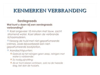 KENMERKEN VERBRANDINGKENMERKEN VERBRANDING
Eerstegraads
Wat kunt u doen bij een eerstegraads
verbranding?
 Koel ongeveer 10 minuten met lauw, zacht
stromend water. Koel alleen de verbrande
lichaamsdelen.
Verzorg de huid met niet-geparfumeerde
crèmes, zoals bijvoorbeeld een niet-
geparfumeerde bodylotion.
 Aandachtspunten:
 Gebruik bij het reinigen geen zeep, reinigen met
water is voldoende;
 Zo nodig pijnstilling;
 Als er toch blaren ontstaan, ook na de tweede
dag, bel dan de huisarts.
 