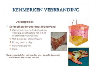 KENMERKEN VERBRANDINGKENMERKEN VERBRANDING
Derdegraads
 Kenmerken derdegraads brandwond:
 Opperhuid en de lederhuid zijn
volledig beschadigd tot in het
onderhuids vetweefsel;
 Wit, beige tot donkerbruin;
 Droog, leerachtig;
 Nauwelijks pijnlijk;
 Stug.
Waarschuw bij (het vermoeden van) een derdegraads
brandwond ALTIJD een dokter!
 