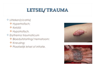 LETSEL/ TRAUMALETSEL/ TRAUMA
 Litteken(cicatrix)
 Hypertrofisch;
 Keloïd;
 Hypotrofisch.
 Erythema traumaticum
 Bloeduitstorting/ hematoom;
 Kneuzing;
 Plaatselijk letsel of irritatie.
 
