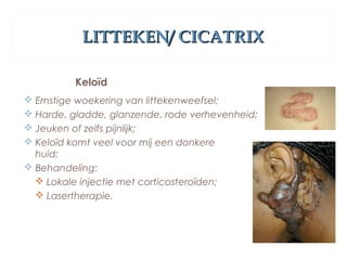 LITTEKEN/ CICATRIXLITTEKEN/ CICATRIX
Keloïd
 Ernstige woekering van littekenweefsel;
 Harde, gladde, glanzende, rode verhevenheid;
 Jeuken of zelfs pijnlijk;
 Keloïd komt veel voor mij een donkere
huid;
 Behandeling:
 Lokale injectie met corticosteroïden;
 Lasertherapie.
 