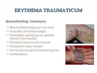 ERYTHEMA TRAUMATICUMERYTHEMA TRAUMATICUM
Bloeduitstorting/ hematoom
 Bloedvatbeschadiging in de huid;
 Huid zelf is niet beschadigd;
 Plaatselijke ophoping van gestold
bloed in het weefsel;
 Ontstaan vaak na een trauma;
 Verdwijnen weer vanzelf;
 Na trauma koude kompressen geven;
 Camoufleren.
 