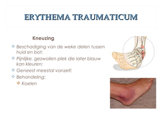 ERYTHEMA TRAUMATICUMERYTHEMA TRAUMATICUM
Kneuzing
 Beschadiging van de weke delen tussen
huid en bot;
 Pijnlijke, gezwollen plek die later blauw
kan kleuren;
 Geneest meestal vanzelf;
 Behandeling:
 Koelen
 