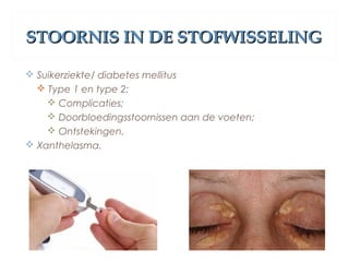 STOORNIS IN DE STOFWISSELINGSTOORNIS IN DE STOFWISSELING
 Suikerziekte/ diabetes mellitus
 Type 1 en type 2:
 Complicaties;
 Doorbloedingsstoornissen aan de voeten;
 Ontstekingen.
 Xanthelasma.
 
