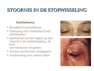 STOORNIS IN DE STOFWISSELINGSTOORNIS IN DE STOFWISSELING
Xanthelasma
 Bruingele huidwoekering;
 Ophoping van cholesterol in het
bindweefsel;
 Xanthomen kunnen wijzen op een
stoornis in de vetstofwisseling, de
lever
kan hierbij een rol spelen;
 Arts kan xanthomen verwijderen;
 Aanbeveling: een vetarm dieet.
 