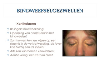 BINDWEEFSELGEZWELLENBINDWEEFSELGEZWELLEN
Xanthelasma
 Bruingele huidwoekering;
 Ophoping van cholesterol in het
bindweefsel;
 Xanthomen kunnen wijzen op een
stoornis in de vetstofwisseling, de lever
kan hierbij een rol spelen;
 Arts kan xanthomen verwijderen;
 Aanbeveling: een vetarm dieet.
 