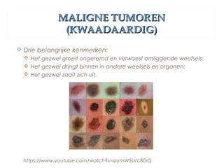 MALIGNE TUMORENMALIGNE TUMOREN
(KWAADAARDIG)(KWAADAARDIG)
 Drie belangrijke kenmerken:
 Het gezwel groeit ongeremd en verwoest omliggende weefsels;
 Het gezwel dringt binnen in andere weefsels en organen;
 Het gezwel zaait zich uit.
https://www.youtube.com/watch?v=aymWSsVc8GQ
 