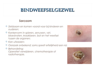 BINDWEEFSELGEZWELBINDWEEFSELGEZWEL
Sarcoom
 Zeldzaam en komen vooral voor bij kinderen en
ouderen;
 Kankervorm in spieren, zenuwen, vet,
bloedvaten, kraakbeen, bot en het weefsel
tussen de organen;
 Kan uitzaaien;
 Oorzaak onbekend; soms speelt erfelijkheid een rol.
 Behandeling:
Operatief verwijderen, chemotherapie of
radiotherapie.
 