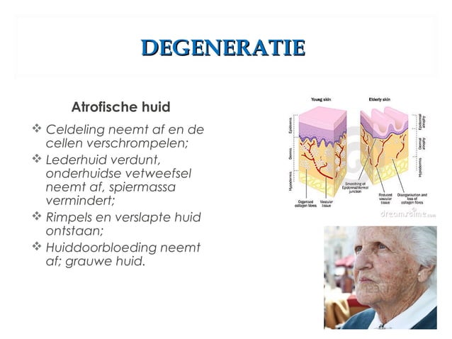 Les huidafwijkingen | PPT