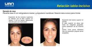 Labio Reposo principios de la cirugia .cx ortognática.pptx