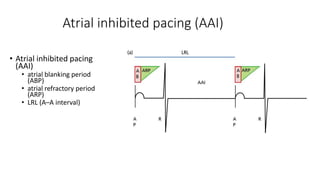 Pacemaker timing cycle harsh.pptx