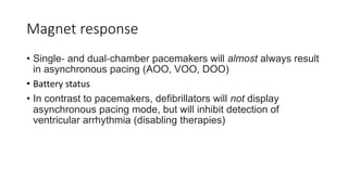 Pacemaker timing cycle harsh.pptx