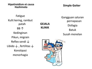 Hipotiroidism et causa              Simple Goiter
     Hashimoto


        Fatigue                    Gangguan saluran
 Kulit kering, rambut                  pernapasan
          patah           GEJALA
                                       Disfagia
         BB ↑             KLINIK
                                        Batuk
      Kedinginan                    Susah menelan
    Pikun, migrain
    Reflex sendi ↓
Libido ↓ , fertilitas ↓
       Konstipasi
     menorhagia
 