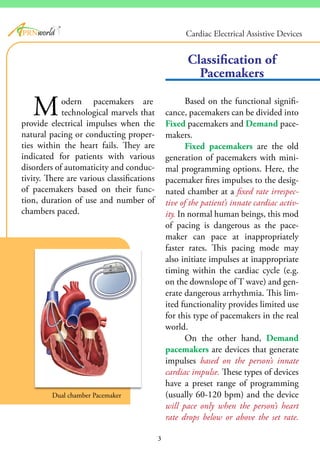 odern pacemakers are
technological marvels that
provide electrical impulses when the
natural pacing or conducting proper-
ties within the heart fails. They are
indicated for patients with various
disorders of automaticity and conduc-
tivity. There are various classifications
of pacemakers based on their func-
tion, duration of use and number of
chambers paced.
Based on the functional signifi-
cance, pacemakers can be divided into
Fixed pacemakers and Demand pace-
makers.
Fixed pacemakers are the old
generation of pacemakers with mini-
mal programming options. Here, the
pacemaker fires impulses to the desig-
nated chamber at a fixed rate irrespec-
tive of the patient’s innate cardiac activ-
ity. In normal human beings, this mod
of pacing is dangerous as the pace-
maker can pace at inappropriately
faster rates. This pacing mode may
also initiate impulses at inappropriate
timing within the cardiac cycle (e.g.
on the downslope of T wave) and gen-
erate dangerous arrhythmia. This lim-
ited functionality provides limited use
for this type of pacemakers in the real
world.
On the other hand, Demand
pacemakers are devices that generate
impulses based on the person’s innate
cardiac impulse. These types of devices
have a preset range of programming
(usually 60-120 bpm) and the device
will pace only when the person’s heart
rate drops below or above the set rate.
Classification of
Pacemakers
Dual chamber Pacemaker
M
3
®
Cardiac Electrical Assistive Devices
 