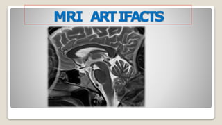 MRI ARTIFACTS
 