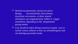 Myopotentials cardiac implantable electronic devices- management | PPTX