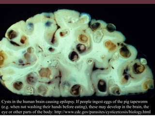 Pig and pork zoonoses in Uganda