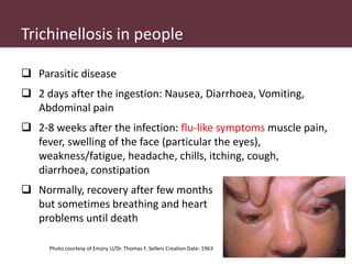 Pig and pork zoonoses in Uganda