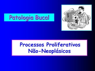 Patologia Bucal
Processos Proliferativos
Não-Neoplásicos
 