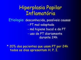 Hiperplasia Papilar
Inflamatória
Etiologia: desconhecida, possíveis causas:
- PT mal-adaptada
- má higiene bucal e da PT
- uso de PT diariamente
durante 24h
* 20% dos pacientes que usam PT por 24h
todos os dias apresentam H. P. I.
 