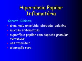 Hiperplasia Papilar
Inflamatória
Caract. Clínicas:
 área mais envolvida: abóbada palatina
 mucosa eritematosa
 superfície papilar com aspecto granular,
verrucoso
 assintomática
 ulceração rara
 